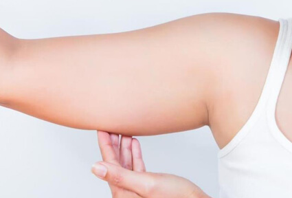 Picture of a woman facing the camera and happy with the perfect arms liposuction procedure she had with top plastic surgeons in beautiful Cabo San Lucas, Mexico.  She is wearing a white top and holding her hand to one arm,  showing the area of the surgery.